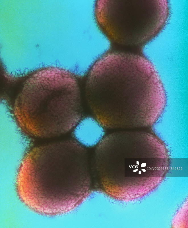 卡他莫拉菌图片素材