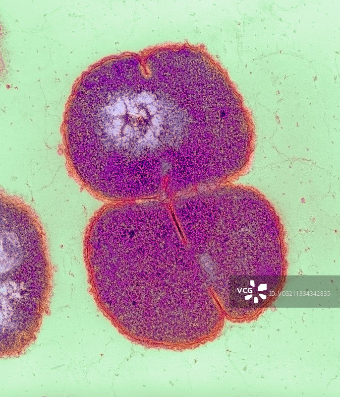 脑膜炎细菌，透射电子显微镜图片素材