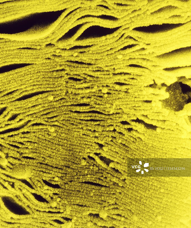 基粒堆叠的扫描电镜图片素材