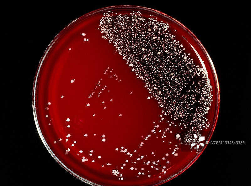 皮肤细菌培养皿图片素材