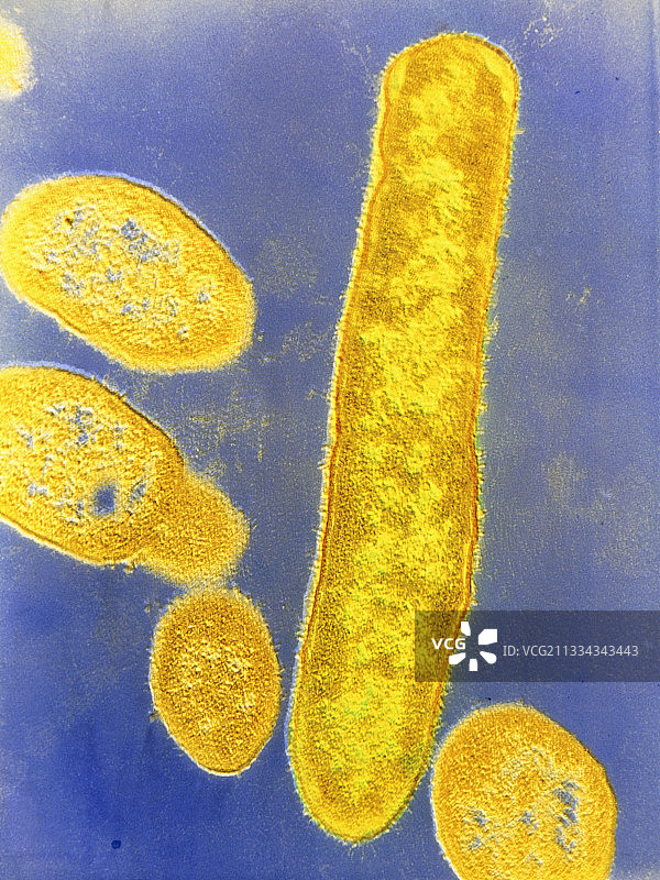 脆弱类杆菌图片素材