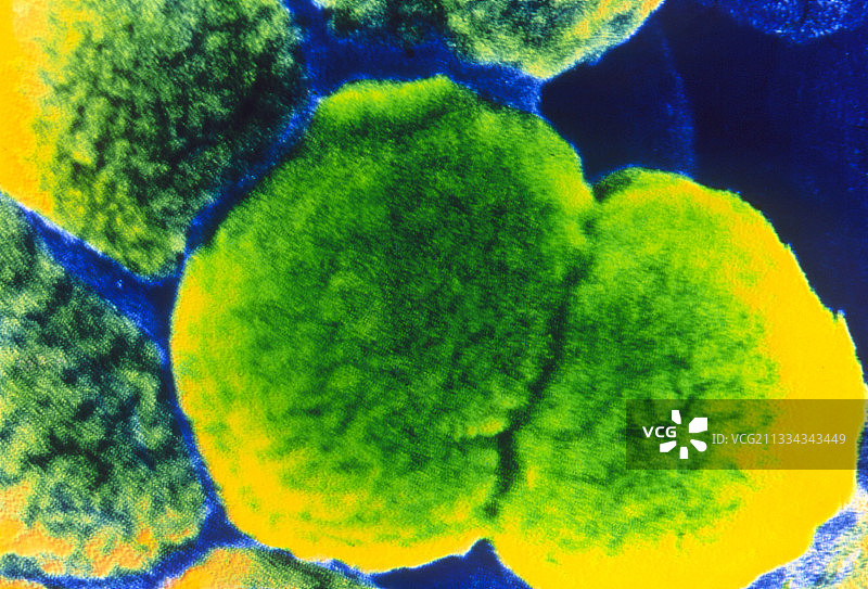 脑膜炎奈瑟菌图片素材