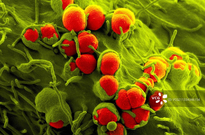 淋病细菌，扫描电镜图片素材