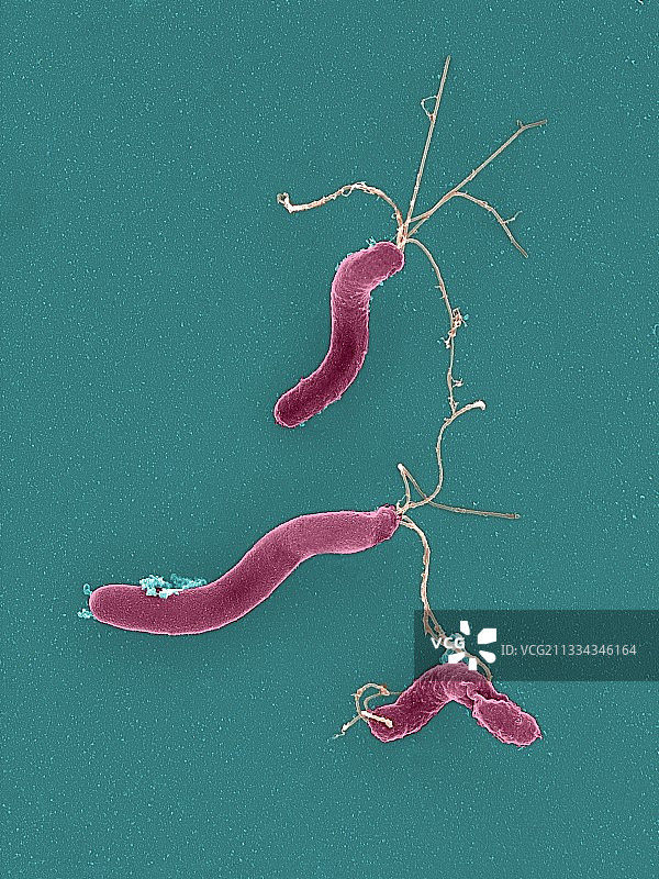 幽门螺杆菌（扫描电镜）图片素材