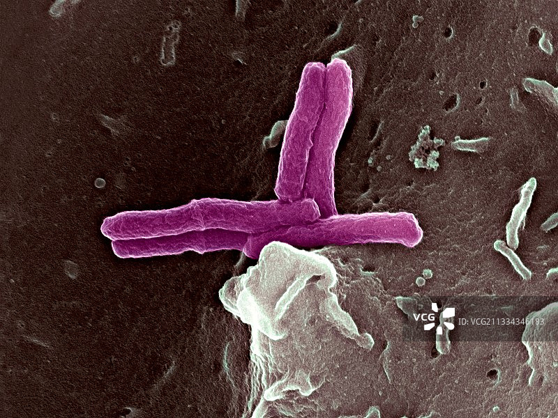 感染巨噬细胞的细菌，扫描电子显微镜图图片素材