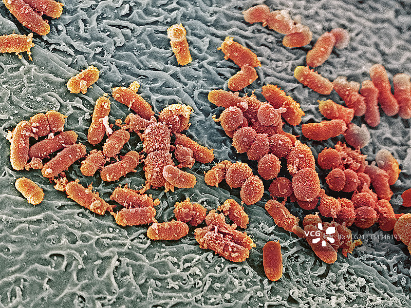 鼻子里的细菌（扫描电镜图）图片素材