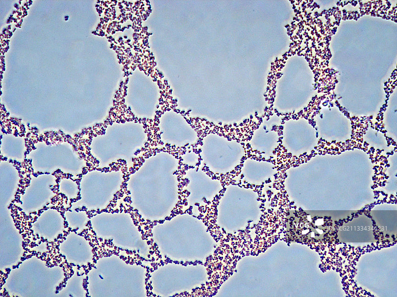 肺炎克雷伯菌图片素材