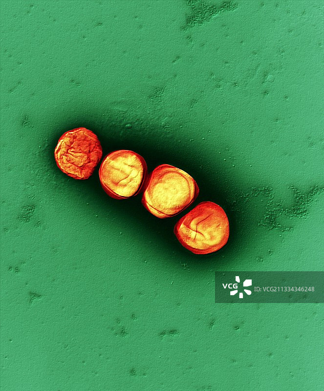 弗朗西斯菌，TEM图片素材