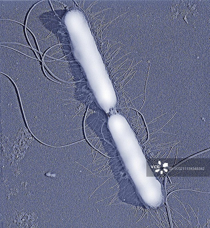 普通变形杆菌细菌扫描电镜图图片素材