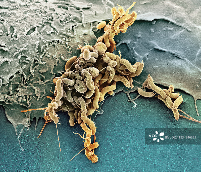幽门螺杆菌（扫描电镜）图片素材