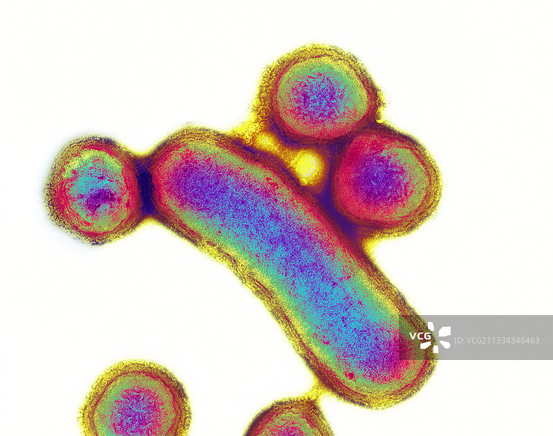 口腔卟啉单胞菌，TEM图片素材
