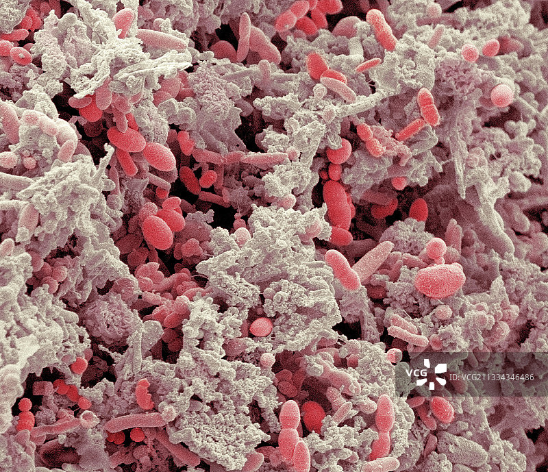 人类粪便材料扫描电镜图图片素材