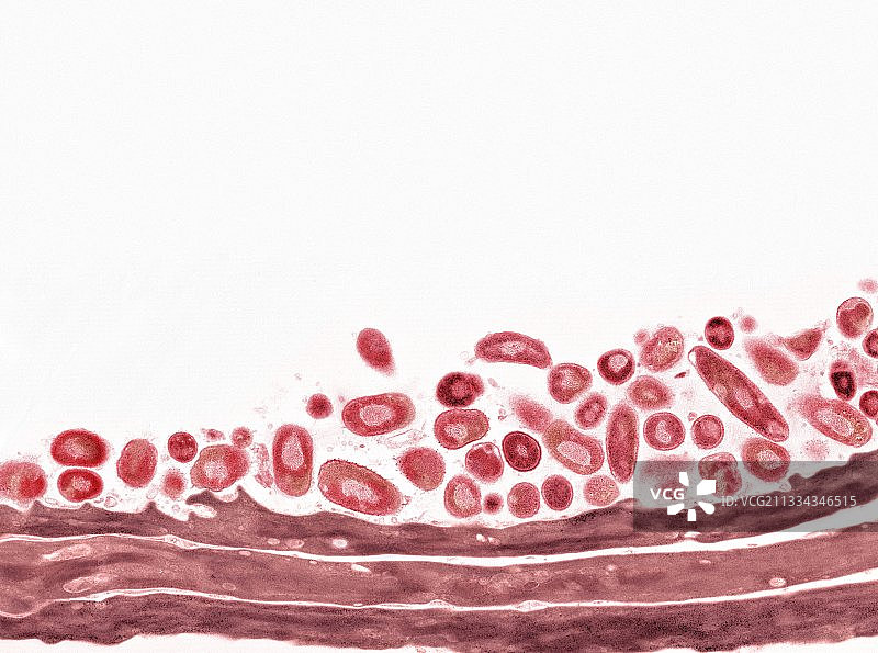 舌头细菌，透射电镜图片素材