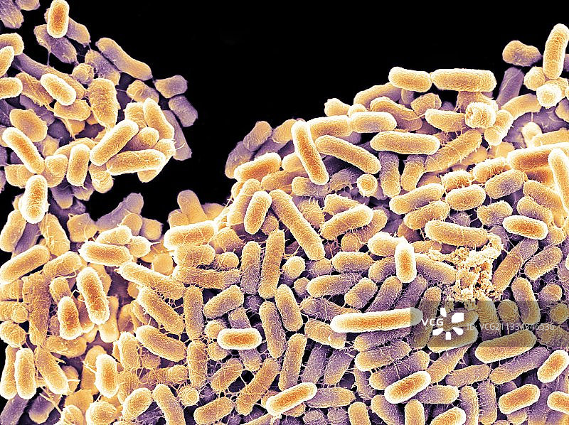 沙门氏菌，扫描电镜图片素材