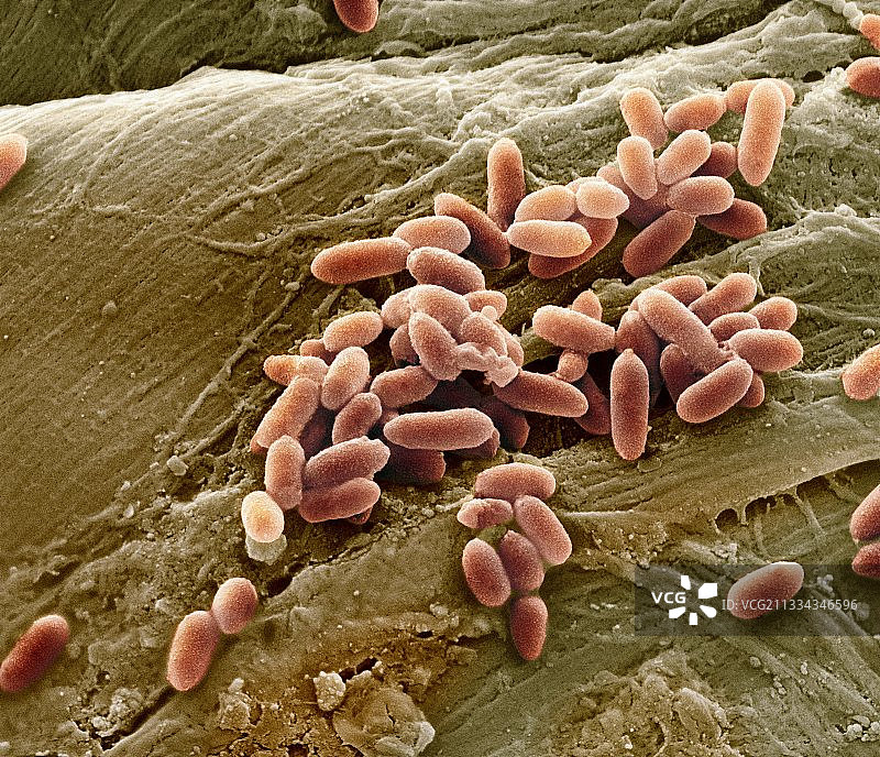 铜绿假单胞菌（扫描电子显微镜）图片素材