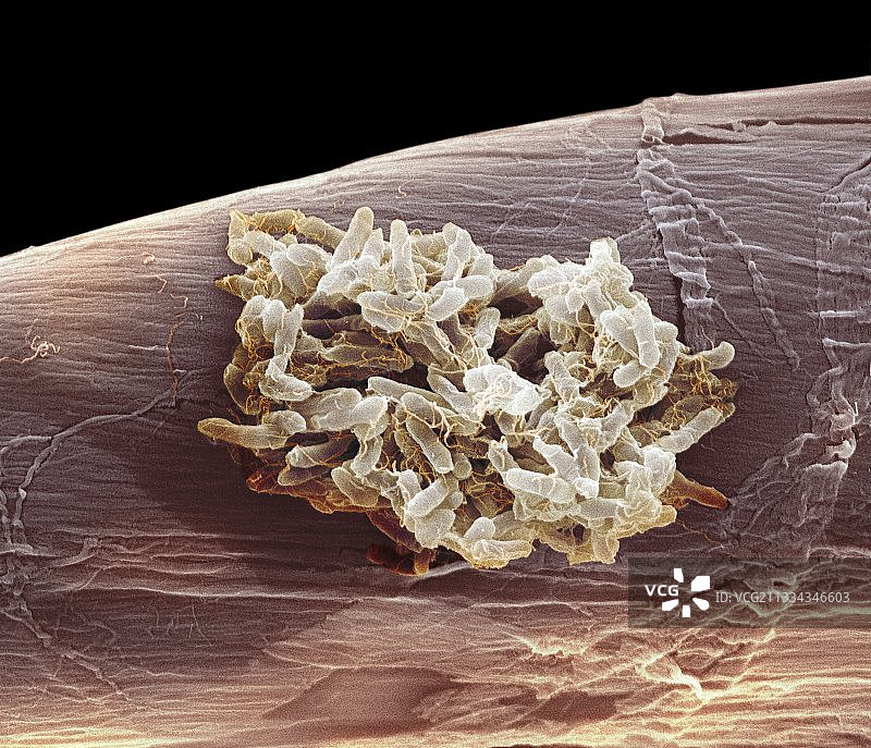 鼠伤寒沙门氏菌细菌扫描电镜图图片素材
