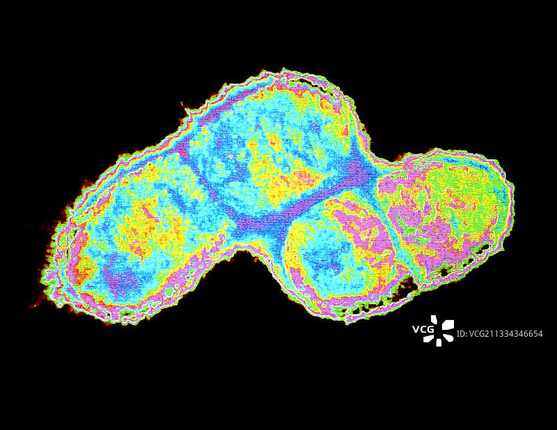 大肠杆菌分裂的伪彩色透射电镜图片素材