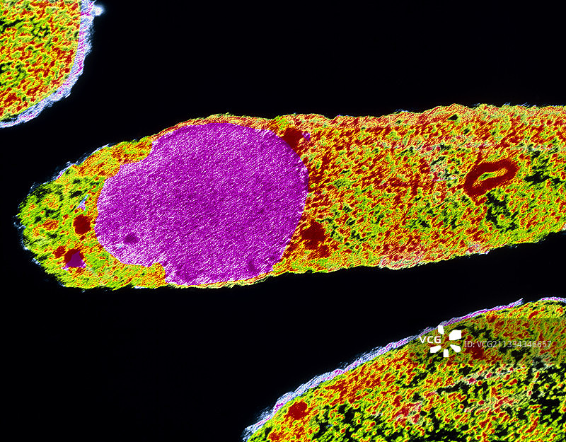 大肠杆菌合成白细胞介素-2图片素材