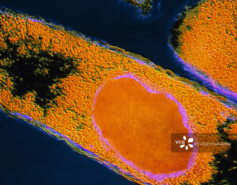 大肠杆菌合成人干扰素图片素材