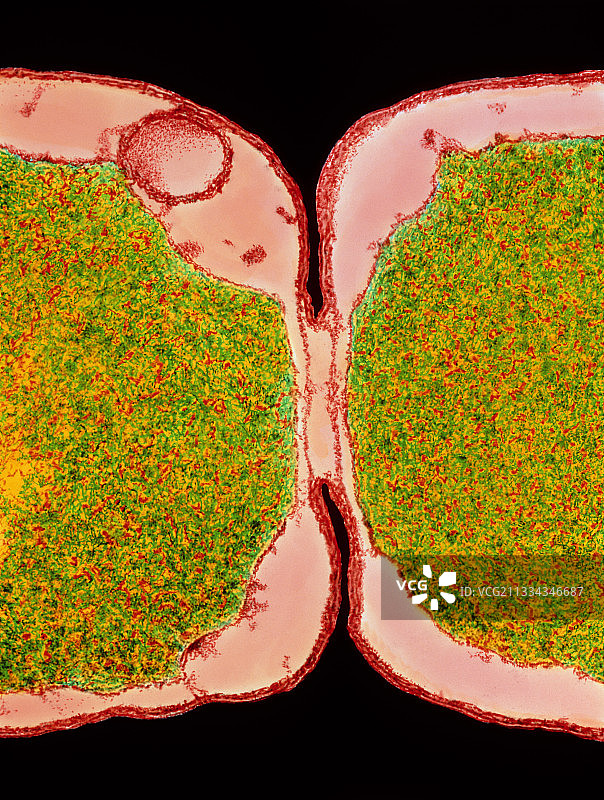 大肠杆菌分裂的彩色透射电镜图图片素材