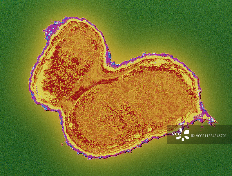 大肠杆菌的彩色透射电镜照片图片素材