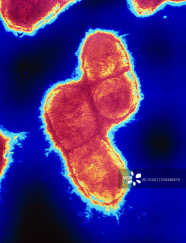 大肠杆菌（透射电镜）图片素材