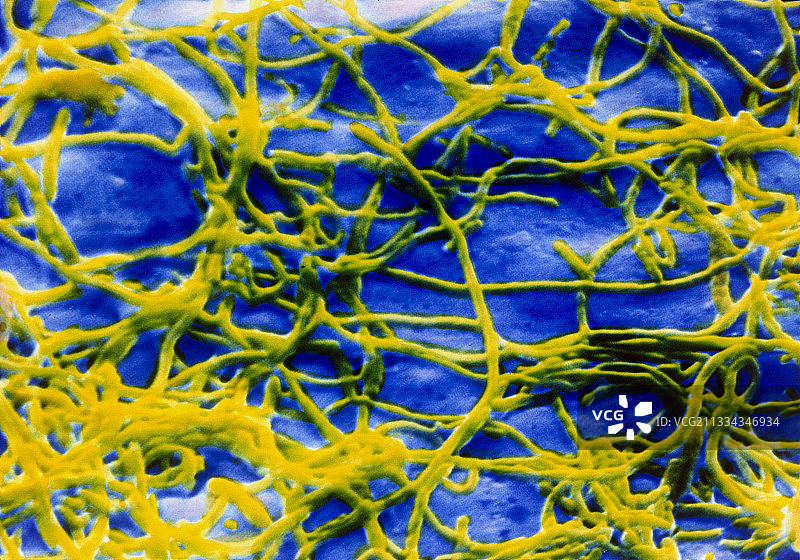 军团菌，扫描电子显微镜图片素材