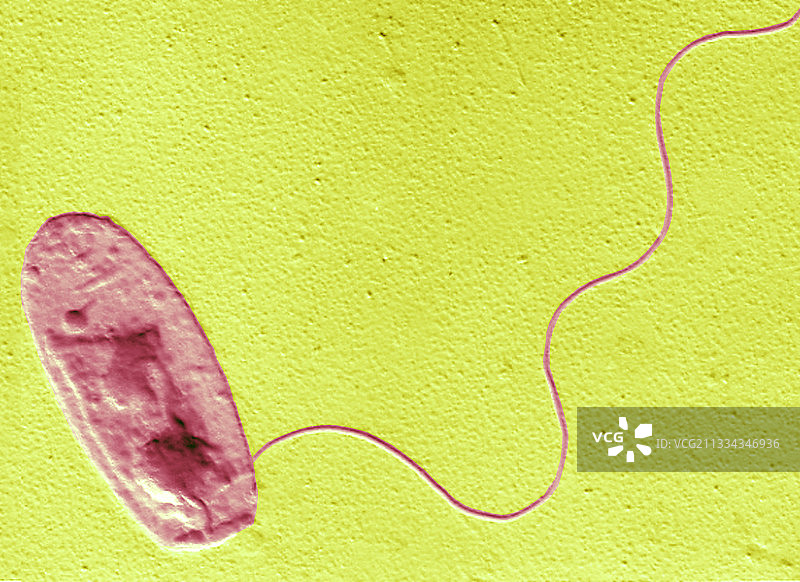 嗜肺军团菌，透射电子显微镜图片素材