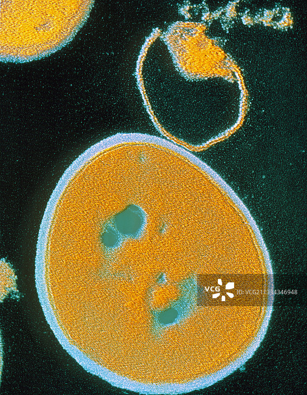 金黄色葡萄球菌的伪彩色透射电镜图图片素材