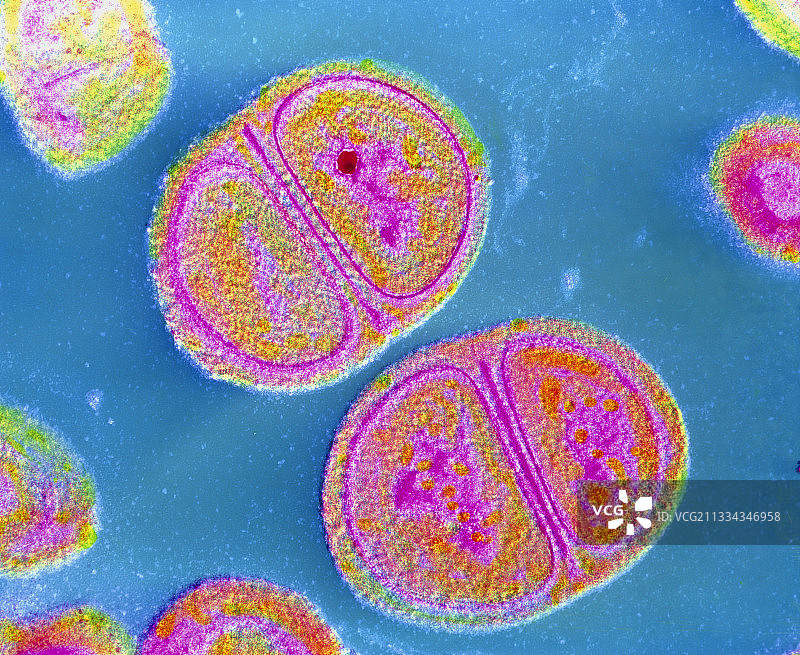 表皮葡萄球菌图片素材