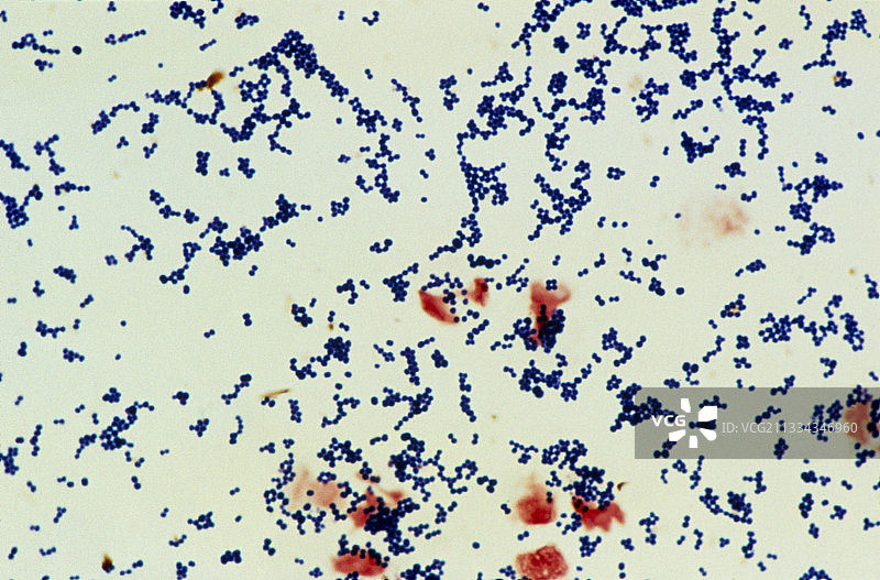 表皮葡萄球菌图片素材