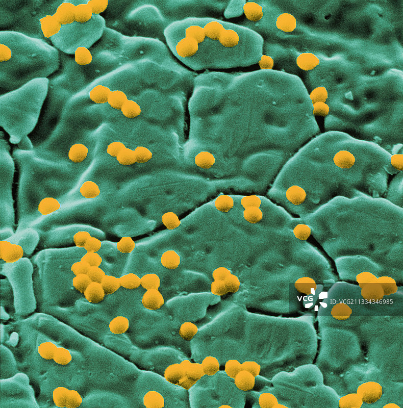 金黄色葡萄球菌图片素材