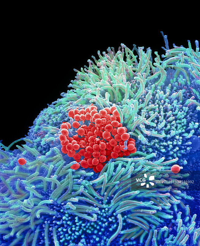 气管中的葡萄球菌图片素材