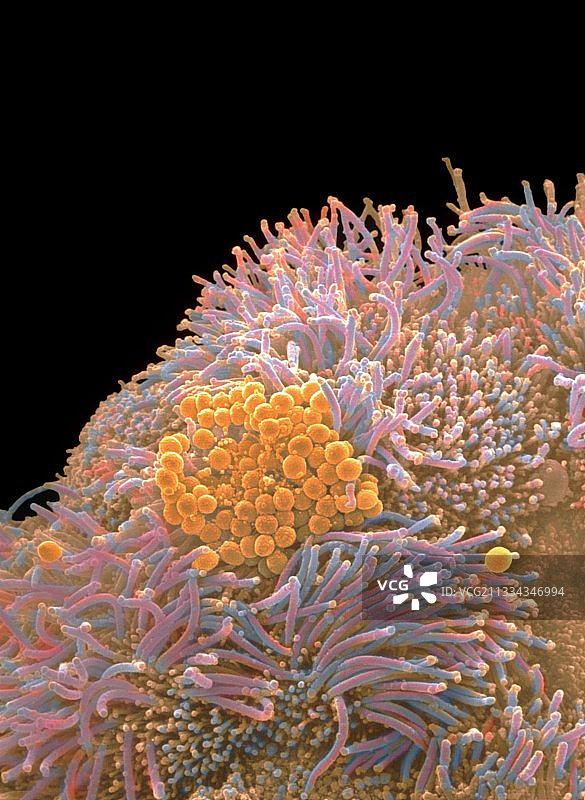 气管中的葡萄球菌图片素材