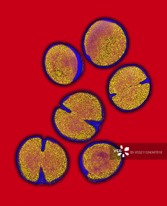 耐甲氧西林金黄色葡萄球菌图片素材