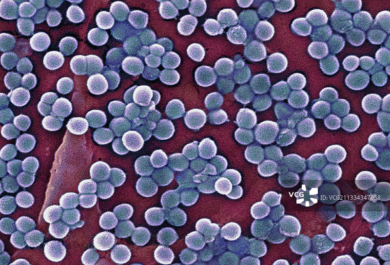 耐甲氧西林金黄色葡萄球菌，扫描电镜图片素材