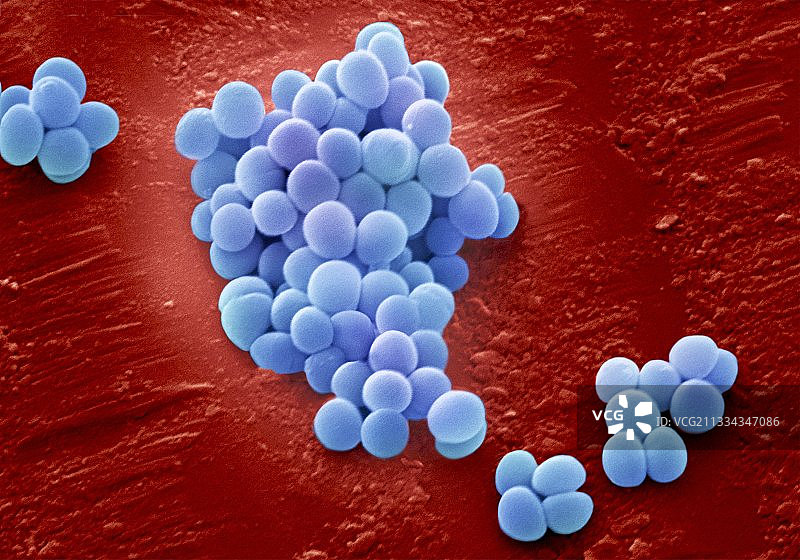 耐甲氧西林金黄色葡萄球菌，扫描电镜图片素材