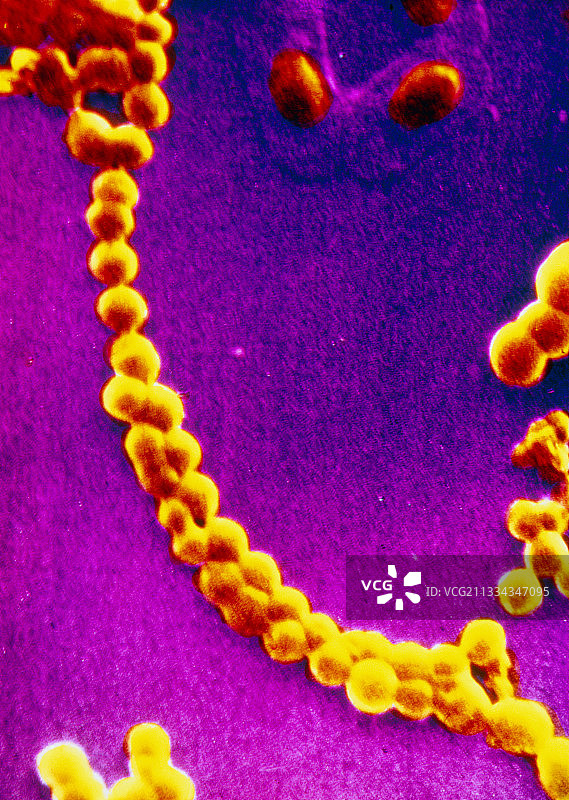 消化链球菌的扫描电镜图片素材