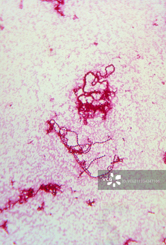 脓液中的化脓性链球菌链图片素材