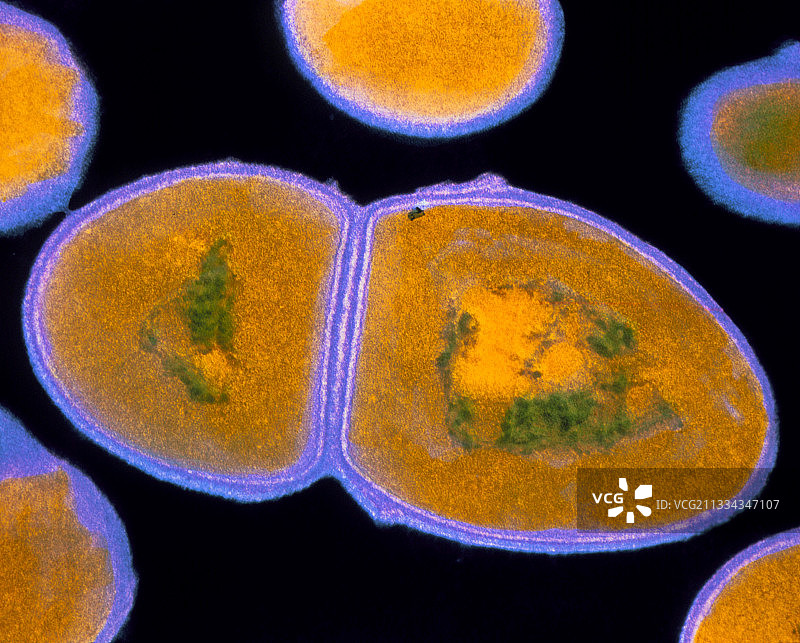 屎肠球菌的透射电镜图像图片素材