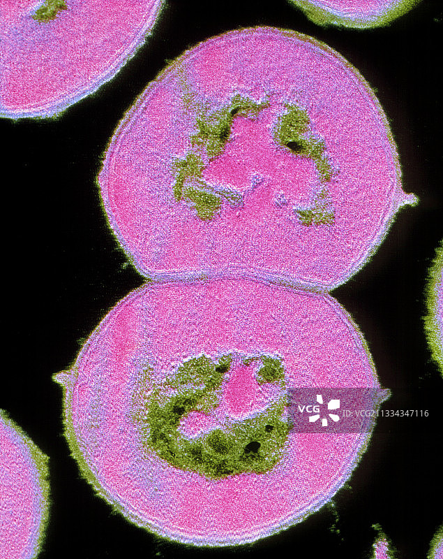 草绿色链球菌假彩色透射电镜图图片素材