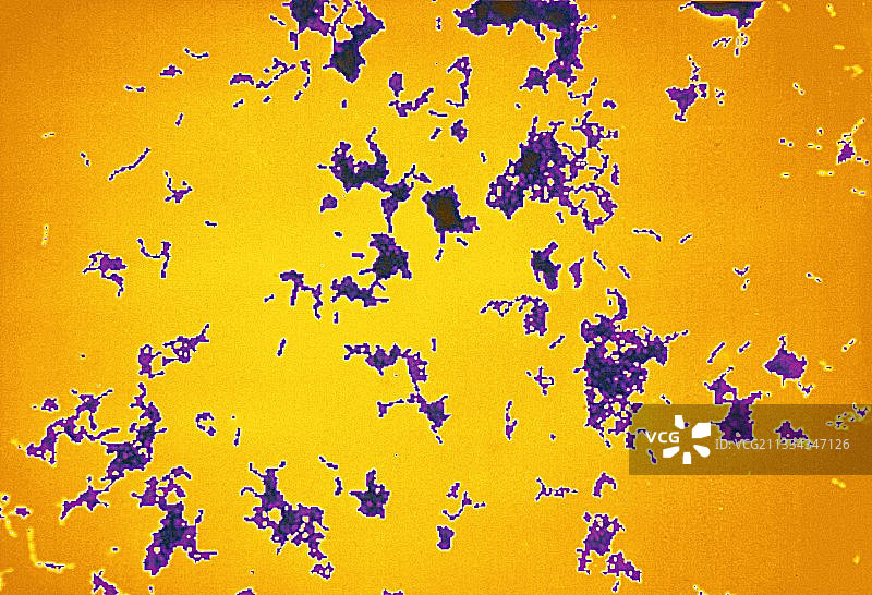 数字化变形链球菌细菌的LM图像图片素材