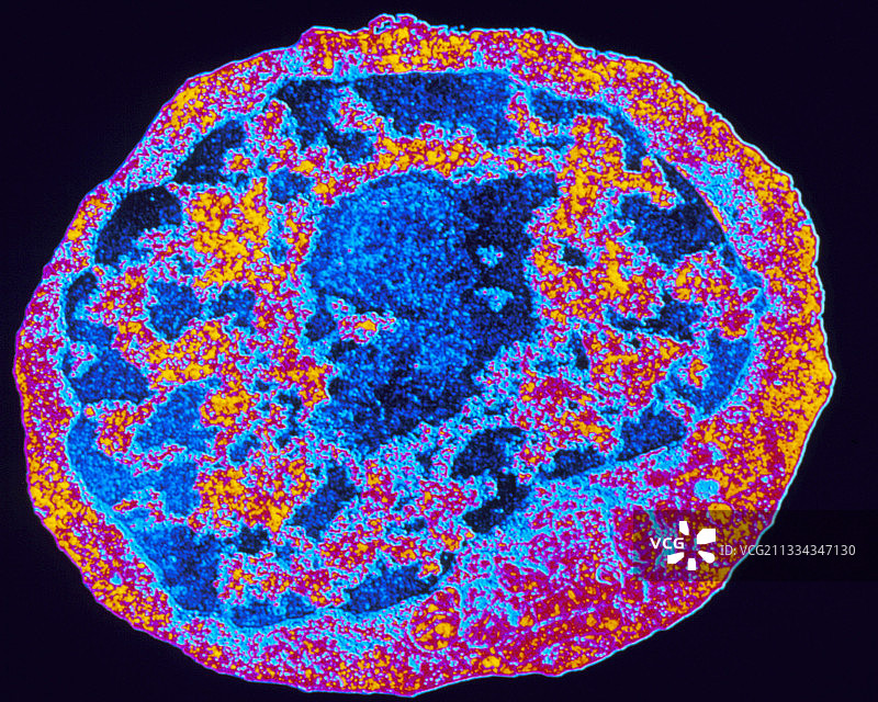 乳酸乳球菌图片素材