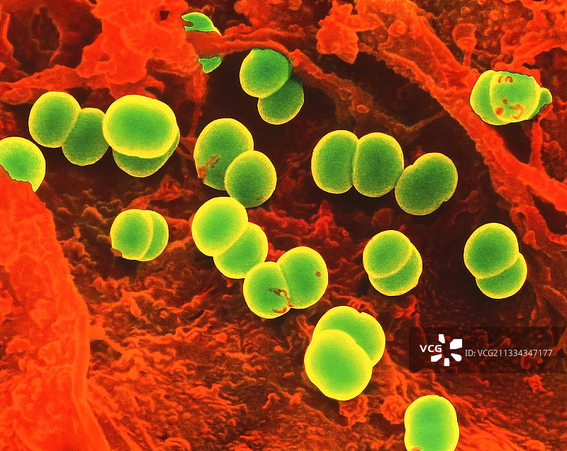 香肠上的肠球菌图片素材