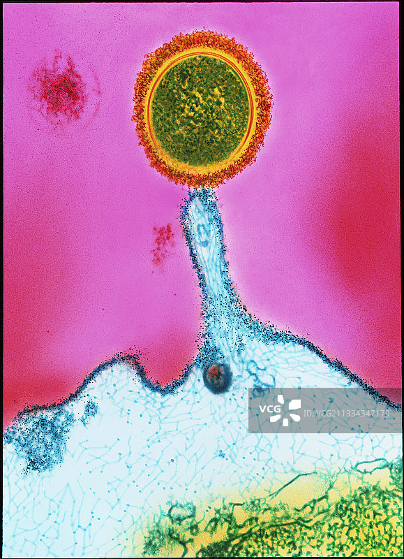 扁桃体链球菌：透射电镜图片素材