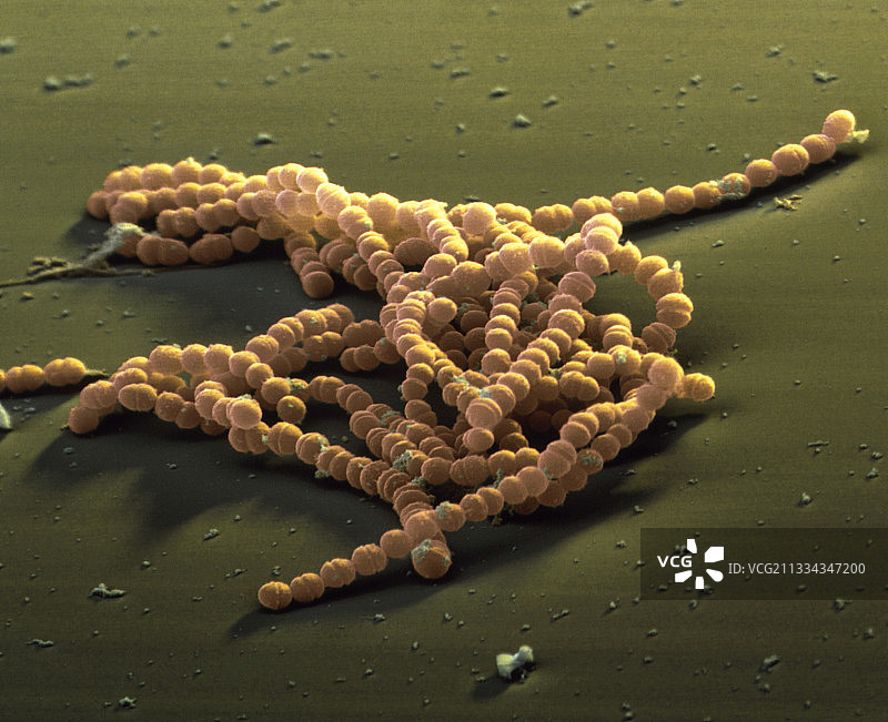 无乳链球菌，彩色扫描电镜图片素材
