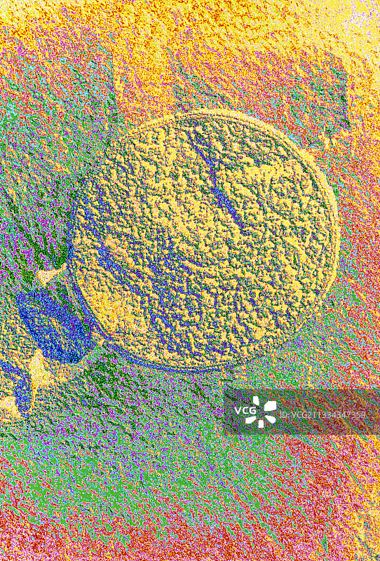 极端嗜热脱硫球菌古细菌图片素材