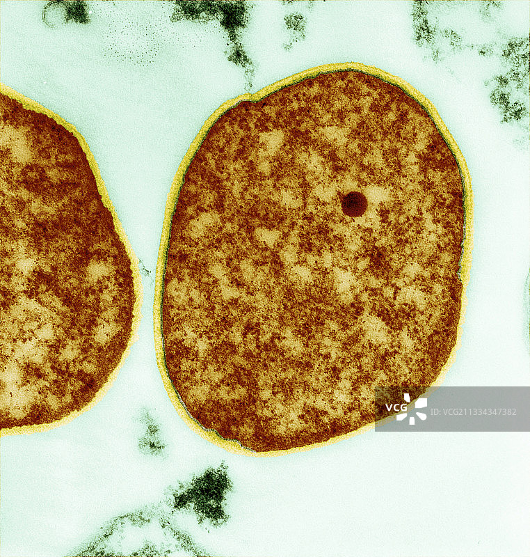 硫化叶菌古细菌，TEM图片素材