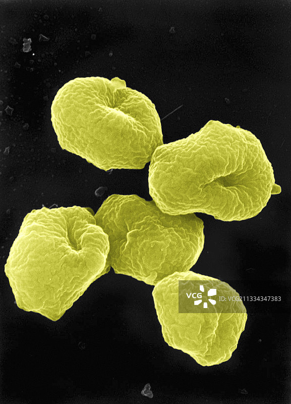 硫磺叶菌的古细菌扫描电镜图图片素材