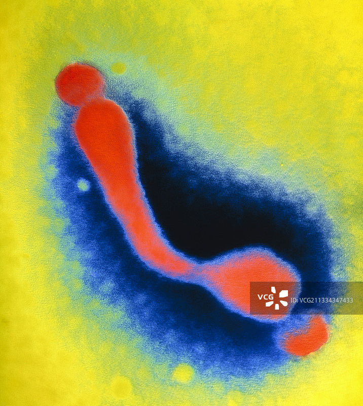 支原体的彩色透射电镜图图片素材